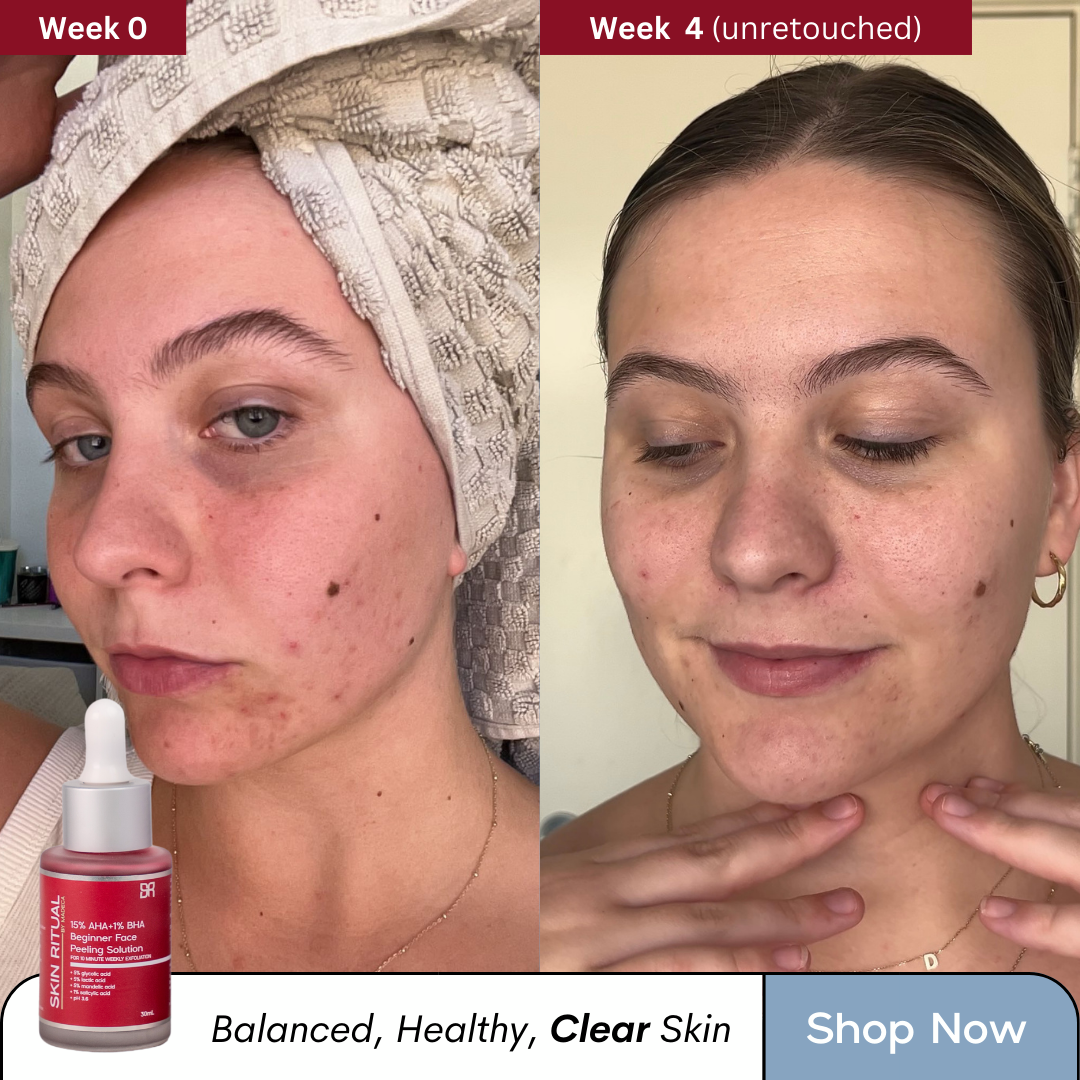 Skin Ritual